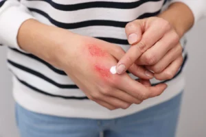 Skin Healing Balm (DIY)